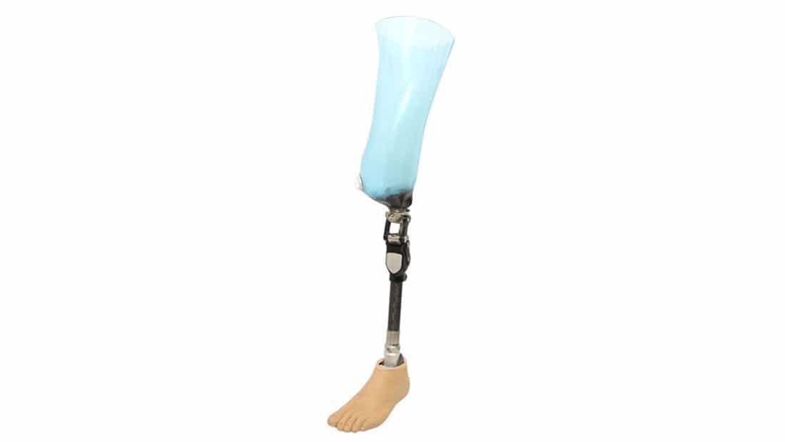 mayer-rexing-knie-exarticulationsinterimsprothese